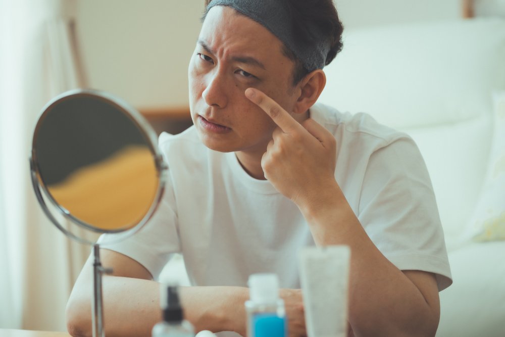 腱膜性眼瞼下垂