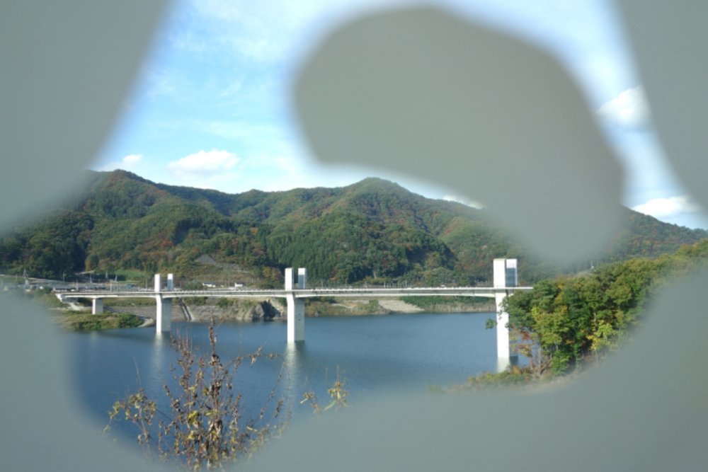 緑内障